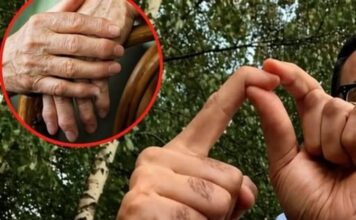 OBLOG KOJI IZVLAČI SAV BOL IZ TIJELA: Provjeren lijek za reumu, išijas, giht i artritis… OBLOG KOJI IZVLAČI SAV BOL IZ TIJELA: Provjeren lijek za reumu, išijas, giht i artritis…