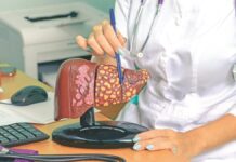 Večera koja skida masnoću sa jetre: Preporuka hepatologa Večera koja skida masnoću sa jetre: Preporuka hepatologa