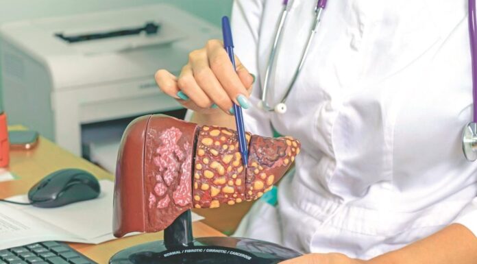 Večera koja skida masnoću sa jetre: Preporuka hepatologa Večera koja skida masnoću sa jetre: Preporuka hepatologa