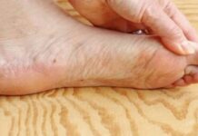 7 znakova da se tijelo već duže vrijeme bori s VISOKIM ŠEĆEROM U KRVI: Prvo ćete to primijetiti na očima i nogama! 7 znakova da se tijelo već duže vrijeme bori s VISOKIM ŠEĆEROM U KRVI: Prvo ćete to primijetiti na očima i nogama!