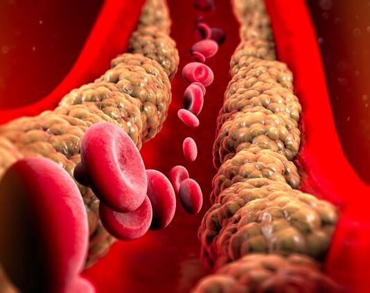 “Kao kardiolog prvo pogledam ova 2 parametra u nalazima laboratorije”: Najvažnija su za otkrivanje bolesti "Kao kardiolog prvo pogledam ova 2 parametra u nalazima laboratorije": Najvažnija su za otkrivanje bolesti