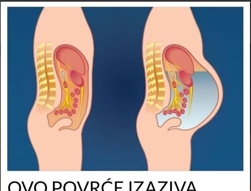 NEMOJTE OVO JESTI AKO ČUVATE LINIJU! Izaziva gasove i nadutost! NEMOJTE OVO JESTI AKO ČUVATE LINIJU! Izaziva gasove i nadutost!