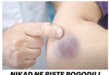 NIKAD NE BISTE POGODILI ZAŠTO SE MODRICE JAVLJAJU PO TIJELU: Nema veze sa POVREDAMA, PRAVI RAZLOG ĆE VAS ŠOKIRATI NIKAD NE BISTE POGODILI ZAŠTO SE MODRICE JAVLJAJU PO TIJELU: Nema veze sa POVREDAMA, PRAVI RAZLOG ĆE VAS ŠOKIRATI