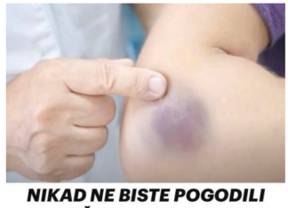 NIKAD NE BISTE POGODILI ZAŠTO SE MODRICE JAVLJAJU PO TIJELU: Nema veze sa POVREDAMA, PRAVI RAZLOG ĆE VAS ŠOKIRATI NIKAD NE BISTE POGODILI ZAŠTO SE MODRICE JAVLJAJU PO TIJELU: Nema veze sa POVREDAMA, PRAVI RAZLOG ĆE VAS ŠOKIRATI