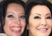 POGLEDAJTE kako su izgledale domaće ličnosti PRIJE UMJETNIH ZUBA – CECA JE HIT (FOTO) POGLEDAJTE kako su izgledale domaće ličnosti PRIJE UMJETNIH ZUBA – CECA JE HIT (FOTO)