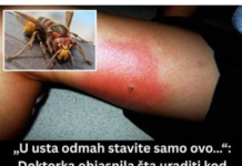 „U usta odmah stavite samo ovo…“: Doktorka objasnila šta uraditi kod ujeda stršljena, prvih 5 minuta su ključni „U usta odmah stavite samo ovo…“: Doktorka objasnila šta uraditi kod ujeda stršljena, prvih 5 minuta su ključni