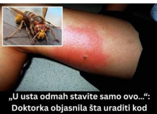 „U usta odmah stavite samo ovo…“: Doktorka objasnila šta uraditi kod ujeda stršljena, prvih 5 minuta su ključni „U usta odmah stavite samo ovo…“: Doktorka objasnila šta uraditi kod ujeda stršljena, prvih 5 minuta su ključni