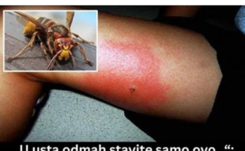 „U usta odmah stavite samo ovo…“: Doktorka objasnila šta uraditi kod ujeda stršljena, prvih 5 minuta su ključni „U usta odmah stavite samo ovo…“: Doktorka objasnila šta uraditi kod ujeda stršljena, prvih 5 minuta su ključni