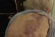 Vratila sam se kući kako bih pomogla svojoj starijoj majci da se okupa. Čim sam posegnula prema njoj, trgnula se kao da ću je udariti. Vratila sam se kući kako bih pomogla svojoj starijoj majci da se okupa. Čim sam posegnula prema njoj, trgnula se kao da ću je udariti.