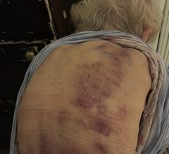 Vratila sam se kući kako bih pomogla svojoj starijoj majci da se okupa. Čim sam posegnula prema njoj, trgnula se kao da ću je udariti. Vratila sam se kući kako bih pomogla svojoj starijoj majci da se okupa. Čim sam posegnula prema njoj, trgnula se kao da ću je udariti.
