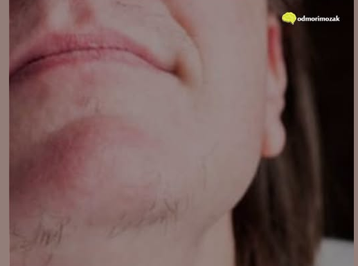ZNATE LI ZAŠTO SE KOD ŽENA JAVLJAJU DLAČICE NA BRADI? Evo šta vam organizam govori ZNATE LI ZAŠTO SE KOD ŽENA JAVLJAJU DLAČICE NA BRADI? Evo šta vam organizam govori
