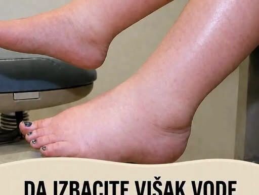 DA IZBACITE VIŠAK VODE POTREBAN VAM JE JEDAN VITAMIN: Ni noge vam više neće oticati, samo ga ubacite u ishranu DA IZBACITE VIŠAK VODE POTREBAN VAM JE JEDAN VITAMIN: Ni noge vam više neće oticati, samo ga ubacite u ishranu
