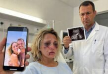 Nakon što me svekrva gurnula niz stepenice, probudila sam se u bolnici, potpisala papire za razvod i nestala bez riječi. Te noći, moj se muž smijao u našem krevetu sa svojom ljubavnicom kad je doktor nazvao…. Nakon što me svekrva gurnula niz stepenice, probudila sam se u bolnici, potpisala papire za razvod i nestala bez riječi. Te noći, moj se muž smijao u našem krevetu sa svojom ljubavnicom kad je doktor nazvao….