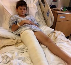Otišla sam u bolnicu da se brinem o sinu koji je imao slomljenu nogu, ali medicinska sestra mi je krišom gurnula komadić papira u ruku i šapnula: „Laže. Provjerite kameru iz sobe u 3 ujutro.“ 😰😨