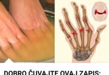 Bolovi u zglobovima ruku i nogu simptomi i lečenje Bolovi u zglobovima ruku i nogu simptomi i lečenje
