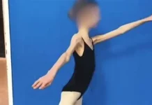 Devojčicu doveli u bolnicu, imala je samo 28 KG I RUČICE TANKE KAO GRISINE: Kad su lekari shvatili koliko ima godina, samo su se UHVATILI ZA GLAVU Devojčicu doveli u bolnicu, imala je samo 28 KG I RUČICE TANKE KAO GRISINE: Kad su lekari shvatili koliko ima godina, samo su se UHVATILI ZA GLAVU