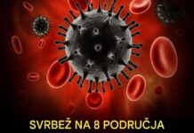 „Šta uzrokuje svrab na različitim dijelovima tijela: kada je bezopasan, a kada potražiti savjet ljekara“ „Šta uzrokuje svrab na različitim dijelovima tijela: kada je bezopasan, a kada potražiti savjet ljekara“