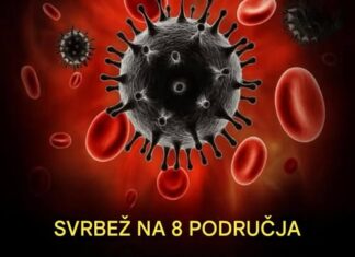 „Šta uzrokuje svrab na različitim dijelovima tijela: kada je bezopasan, a kada potražiti savjet ljekara“ „Šta uzrokuje svrab na različitim dijelovima tijela: kada je bezopasan, a kada potražiti savjet ljekara“
