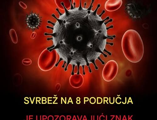 „Šta uzrokuje svrab na različitim dijelovima tijela: kada je bezopasan, a kada potražiti savjet ljekara“ „Šta uzrokuje svrab na različitim dijelovima tijela: kada je bezopasan, a kada potražiti savjet ljekara“